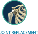 Joint Replacement - Dr James Mclean - Ortopaedic Surgeon
